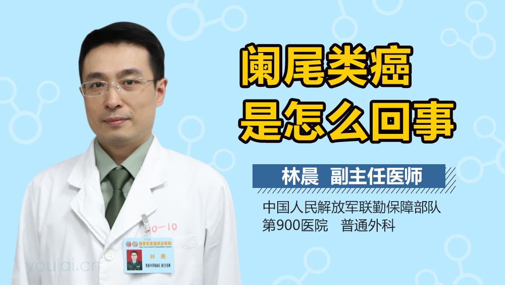 阑尾类癌是怎么回事