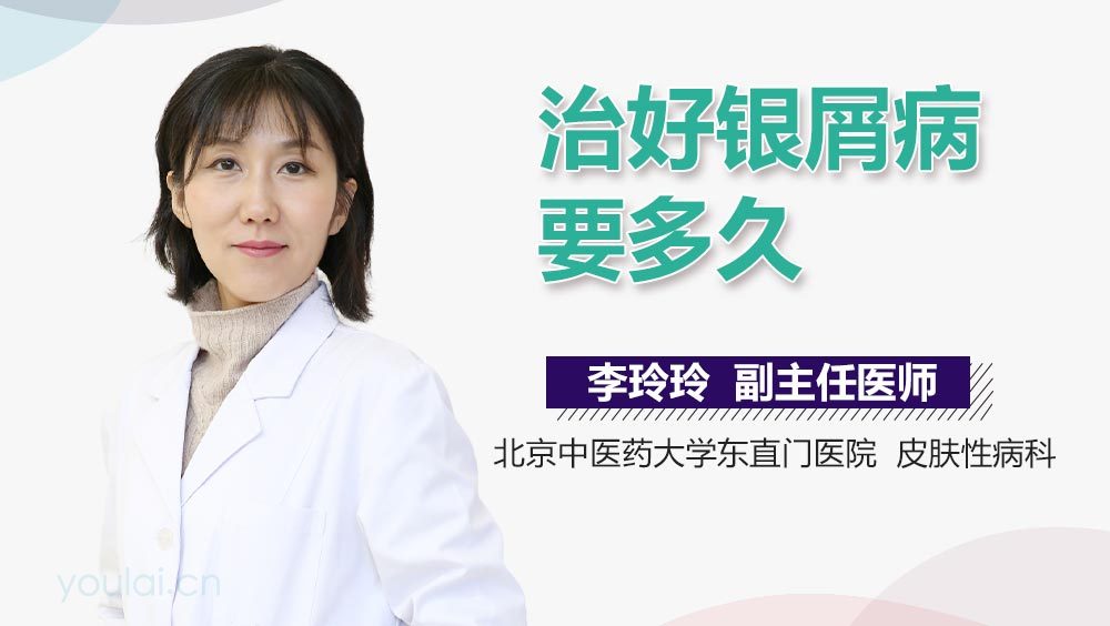 治好银屑病要多久