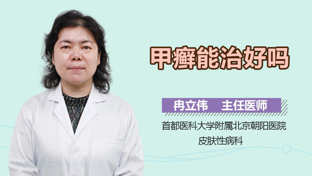 甲癣能治好吗