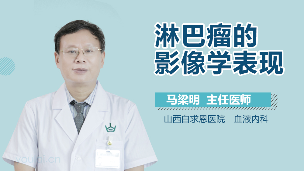 淋巴瘤的影像学表现