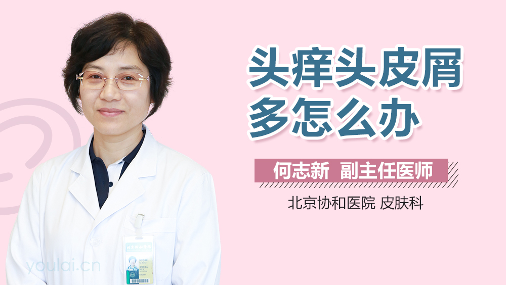 头痒头皮屑多怎么办