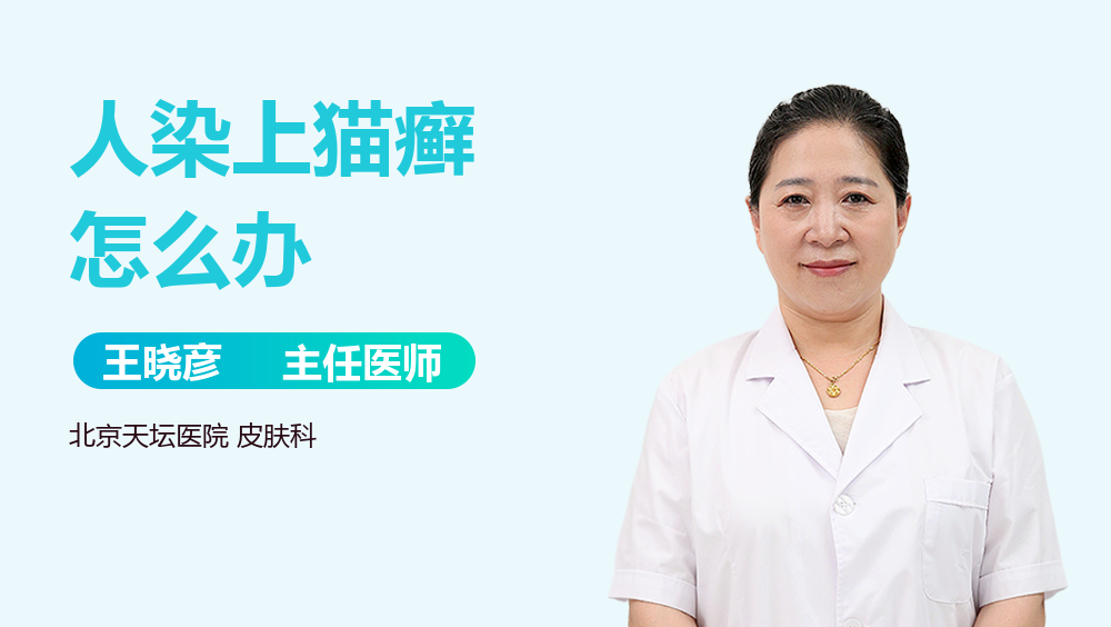 人染上猫癣怎么办