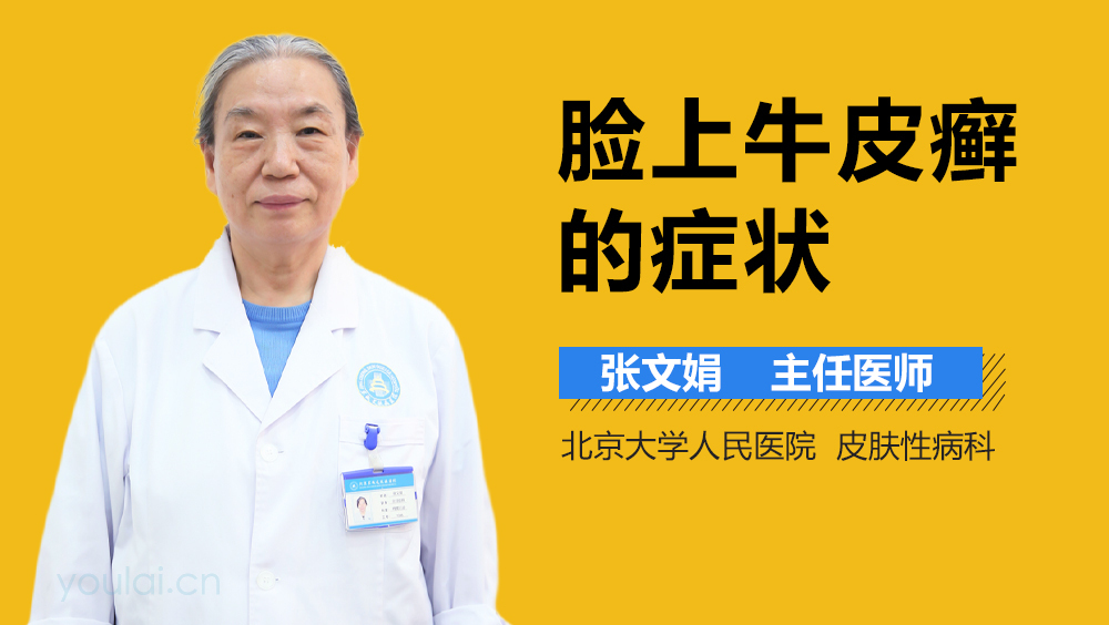 脸上牛皮癣的症状