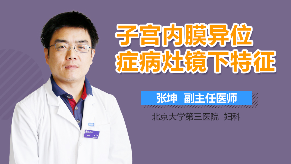 子宫内膜异位症病灶镜下特征