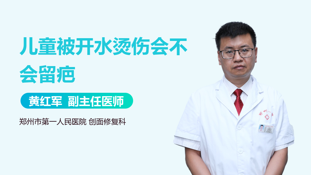 儿童被开水烫伤会不会留疤