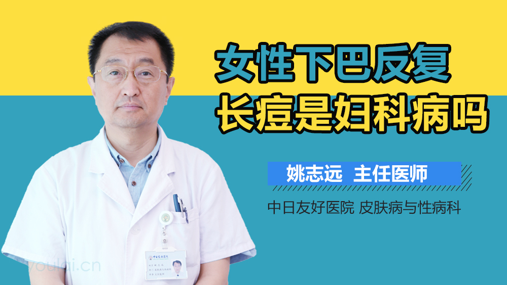 女性下巴反复长痘是妇科病吗