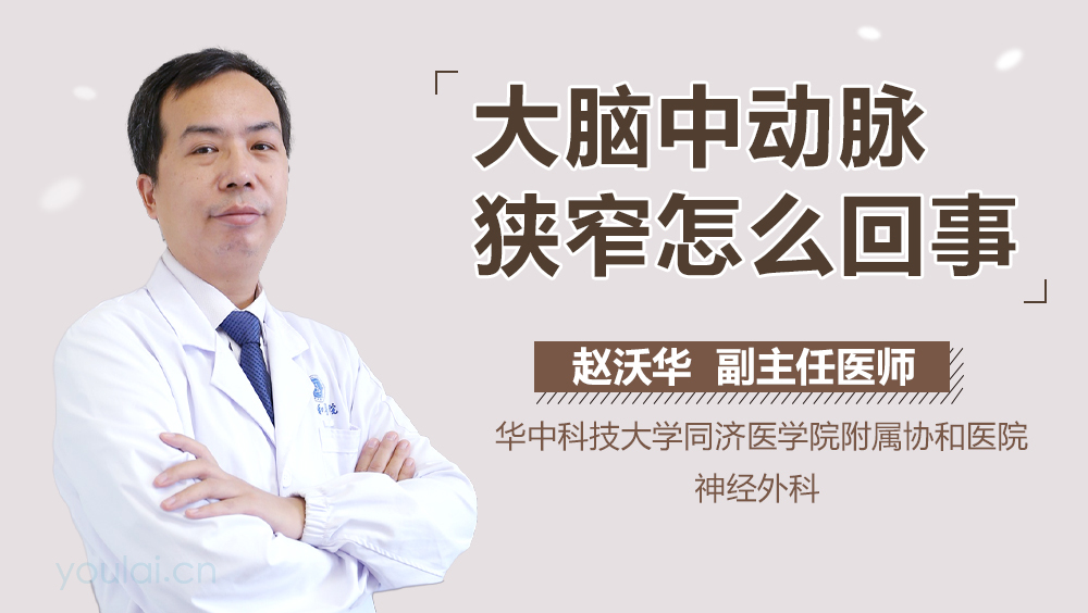 大脑中动脉狭窄怎么回事