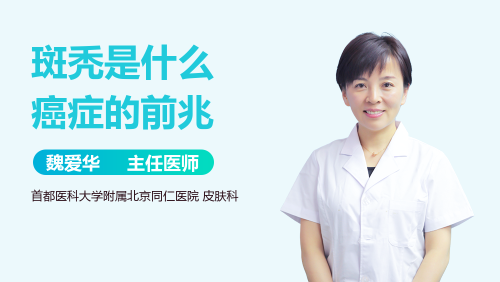 斑秃是什么癌症的前兆