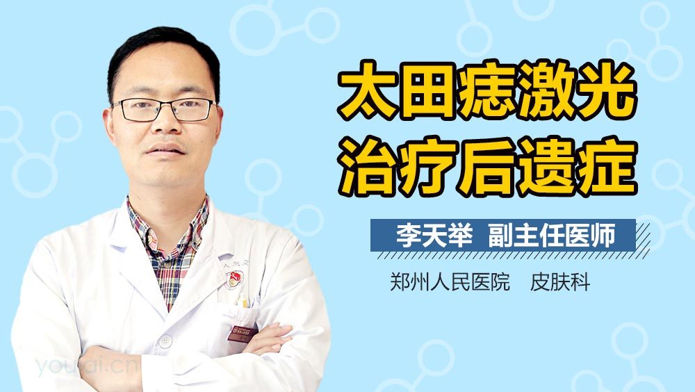 太田痣激光治疗后遗症