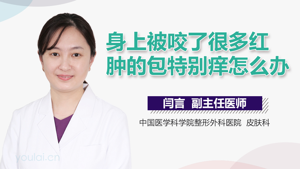 身上被咬了很多红肿的包特别痒怎么办