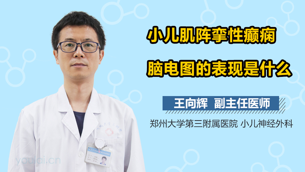 小儿肌阵挛性癫痫脑电图的表现是什么