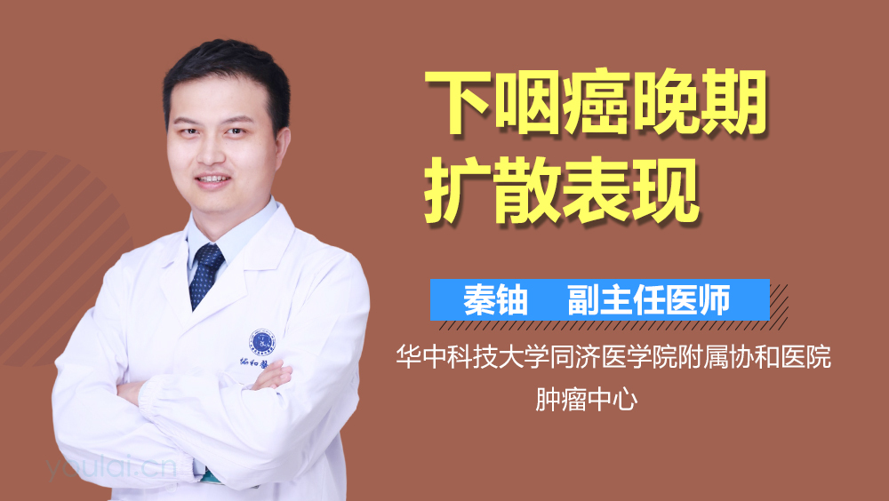 下咽癌晚期扩散表现