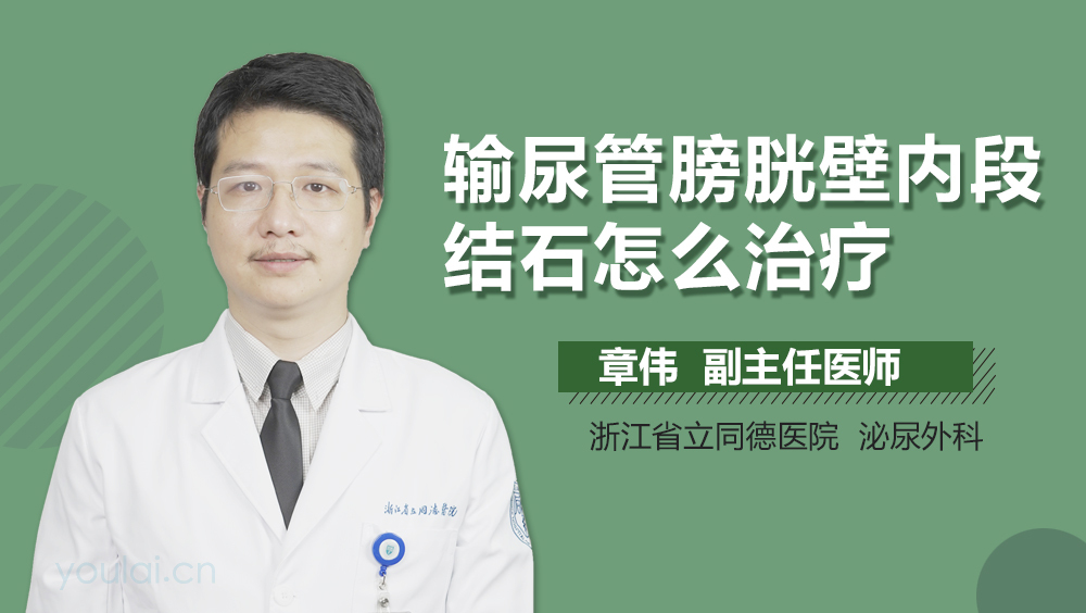 输尿管膀胱壁内段结石怎么治疗