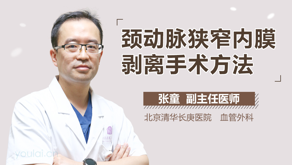 颈动脉狭窄内膜剥离手术方法