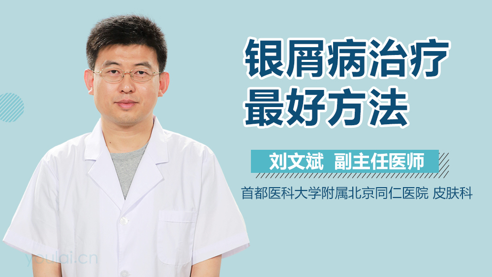 银屑病治疗最好方法