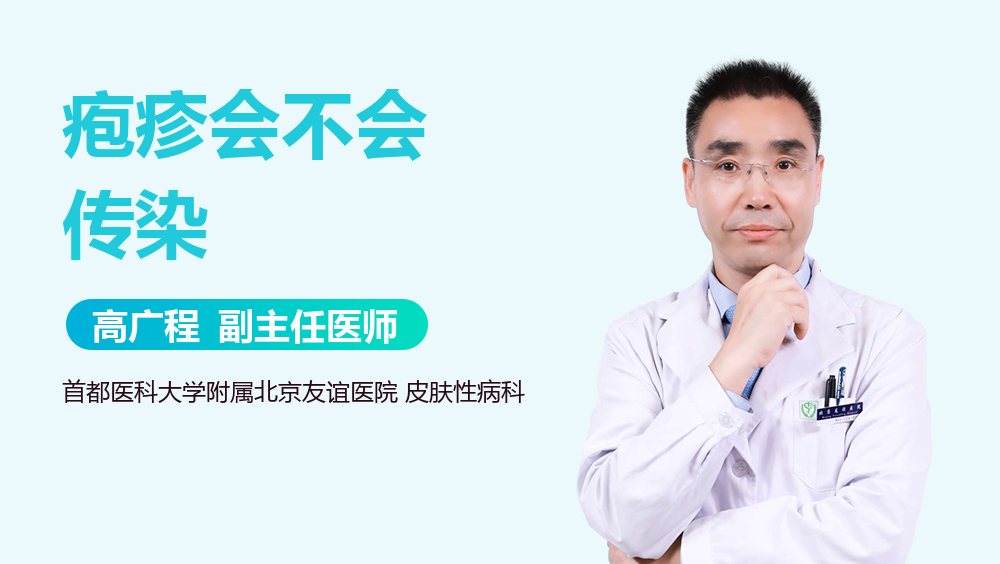 疱疹会不会传染