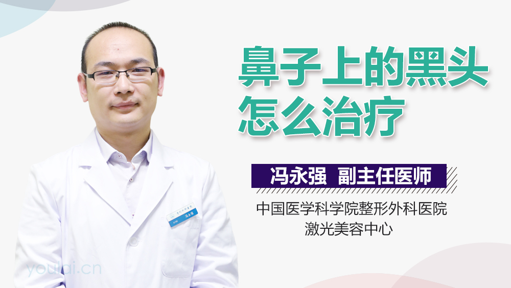 鼻子上的黑头怎么治疗