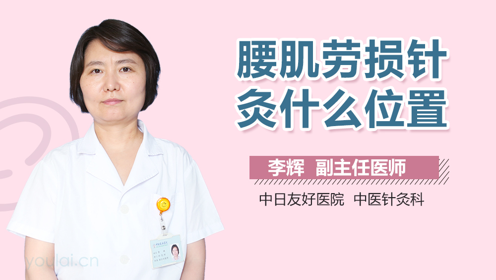 腰肌劳损针灸什么位置