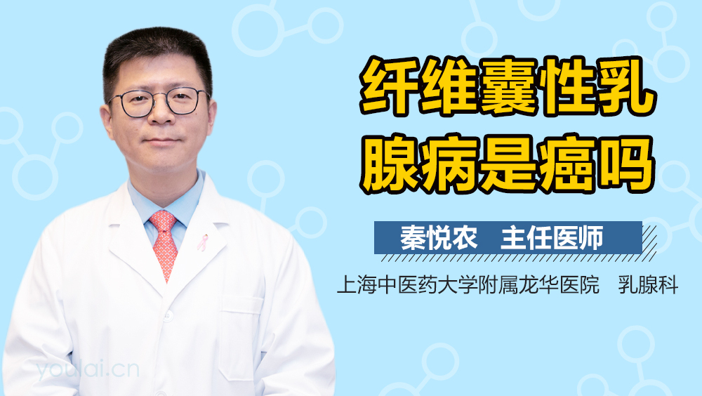 纤维囊性乳腺病是癌吗