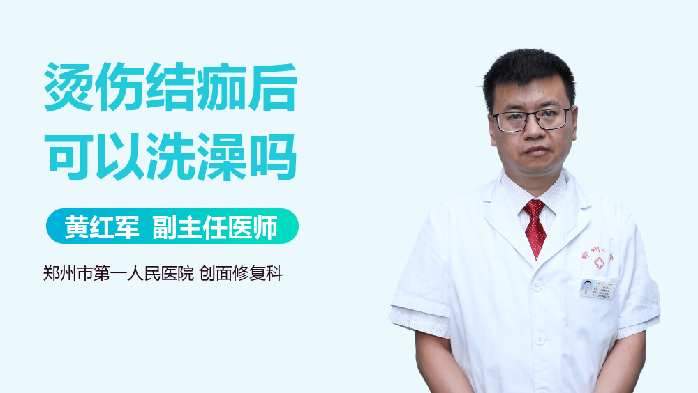 烫伤结痂后可以洗澡吗