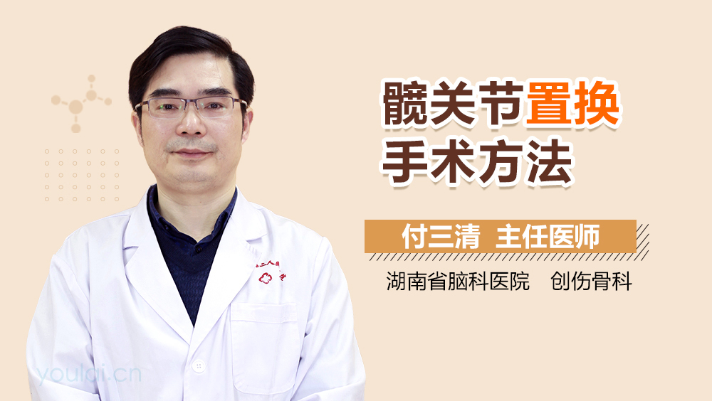 髋关节置换手术方法