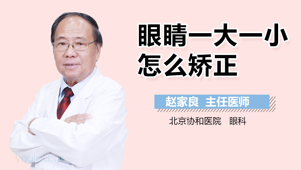 眼睛一大一小怎么矫正