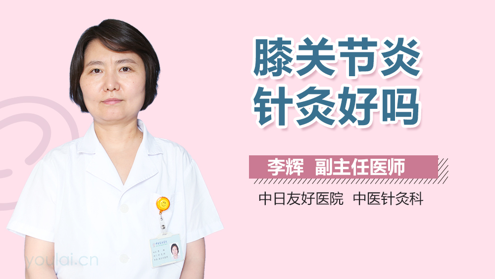 膝关节炎针灸好吗