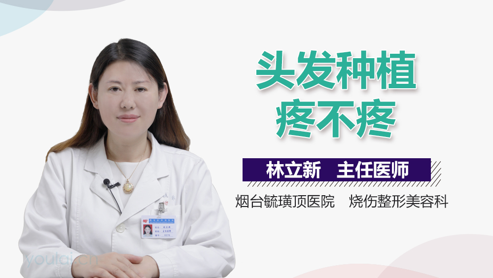 头发种植疼不疼