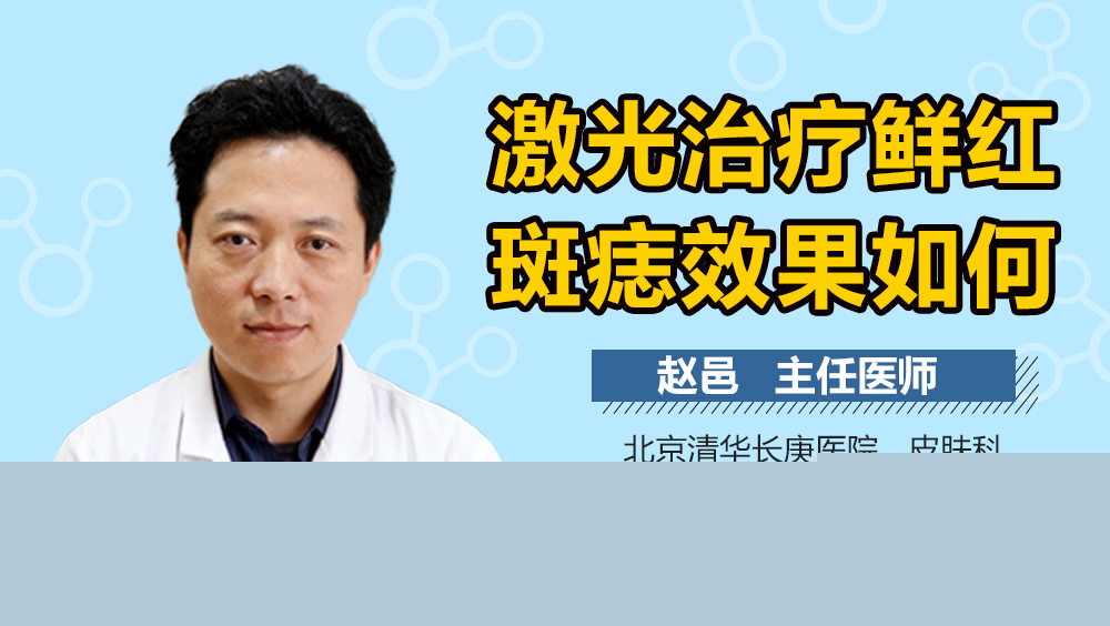激光治疗鲜红斑痣效果如何
