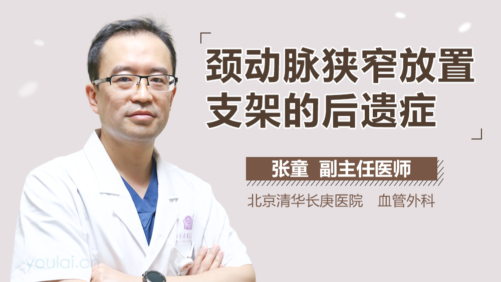 颈动脉狭窄放置支架的后遗症