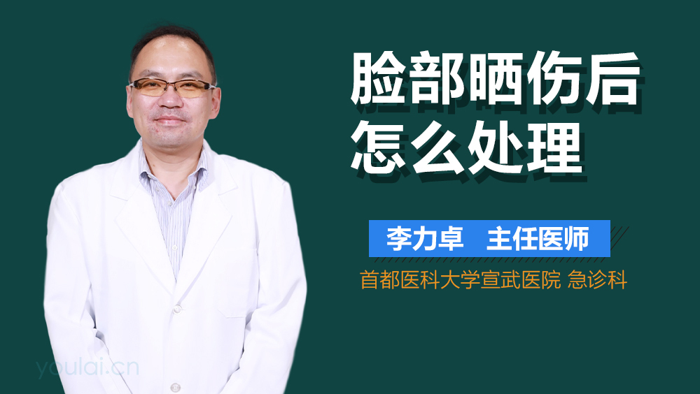 脸部晒伤后怎么处理