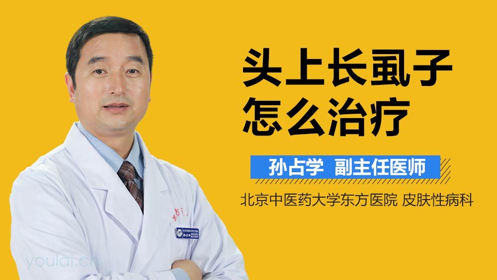 头上长虱子怎么治疗