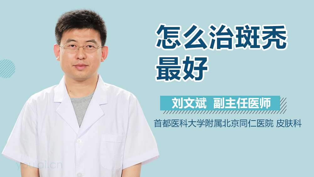 怎么治斑秃最好