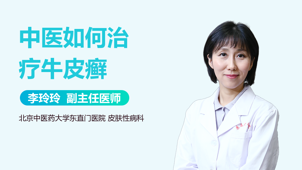 中医如何治疗牛皮癣