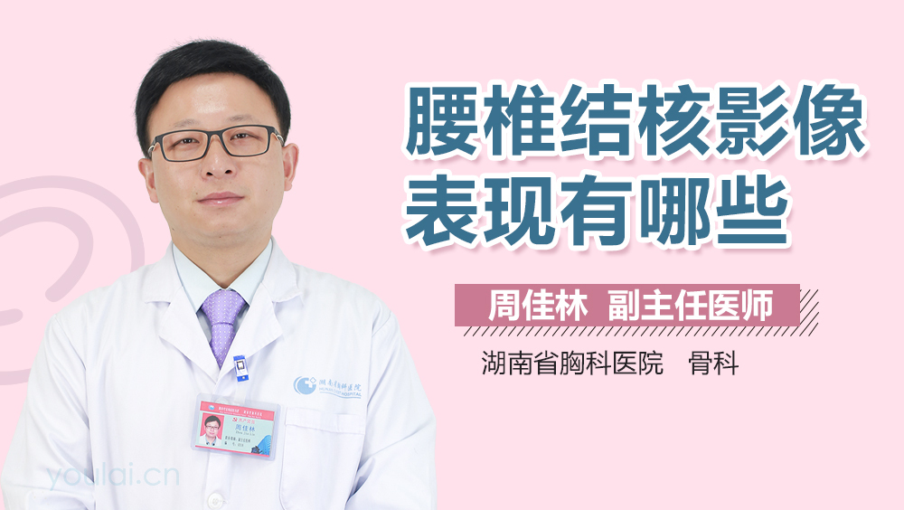 腰椎结核影像表现有哪些