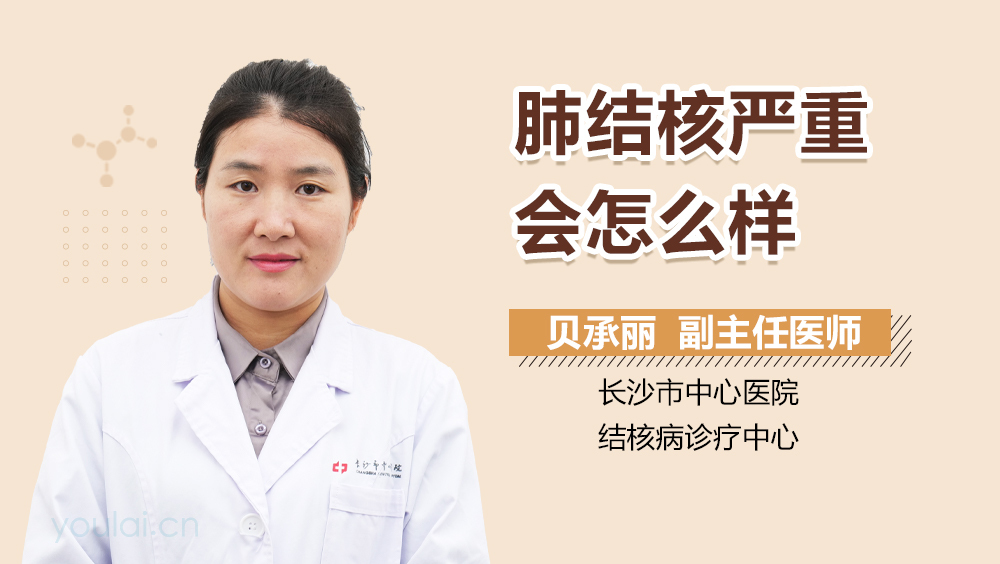 肺结核严重会怎么样