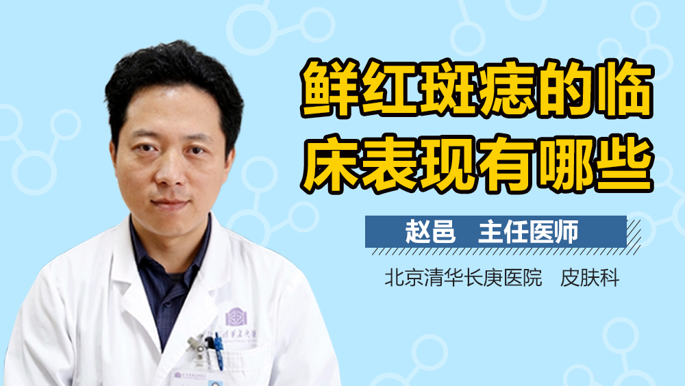 鲜红斑痣的临床表现有哪些