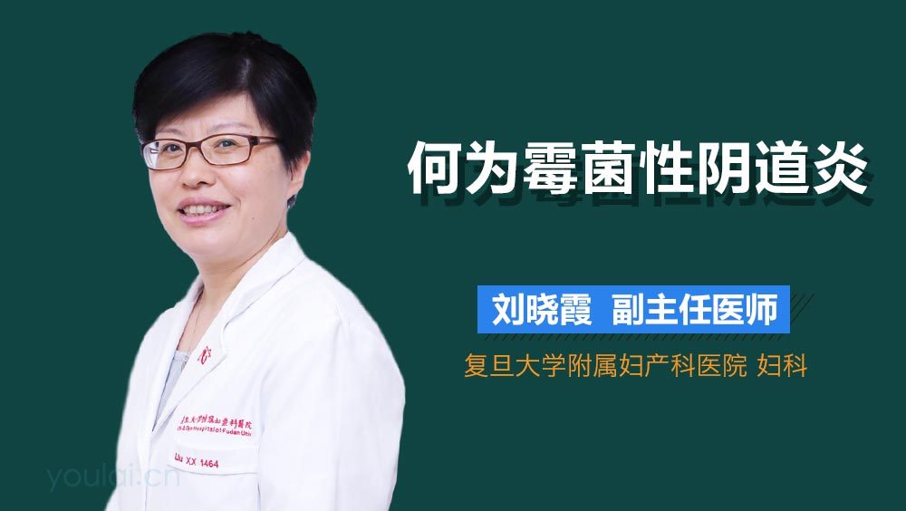 何为霉菌性阴道炎