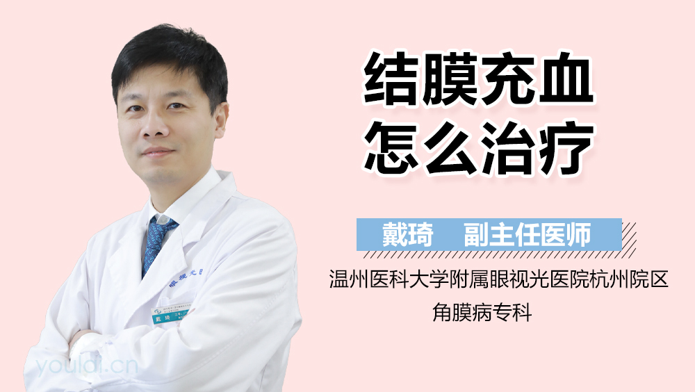 结膜充血怎么治疗