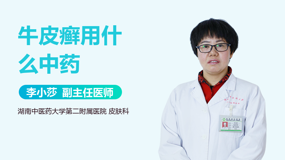 牛皮癣用什么中药