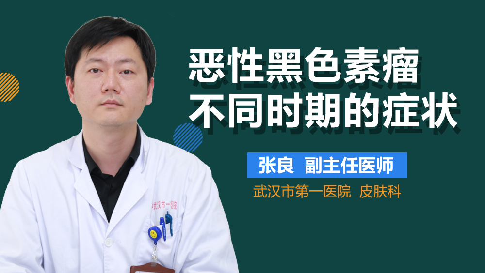 恶性黑色素瘤不同时期的症状