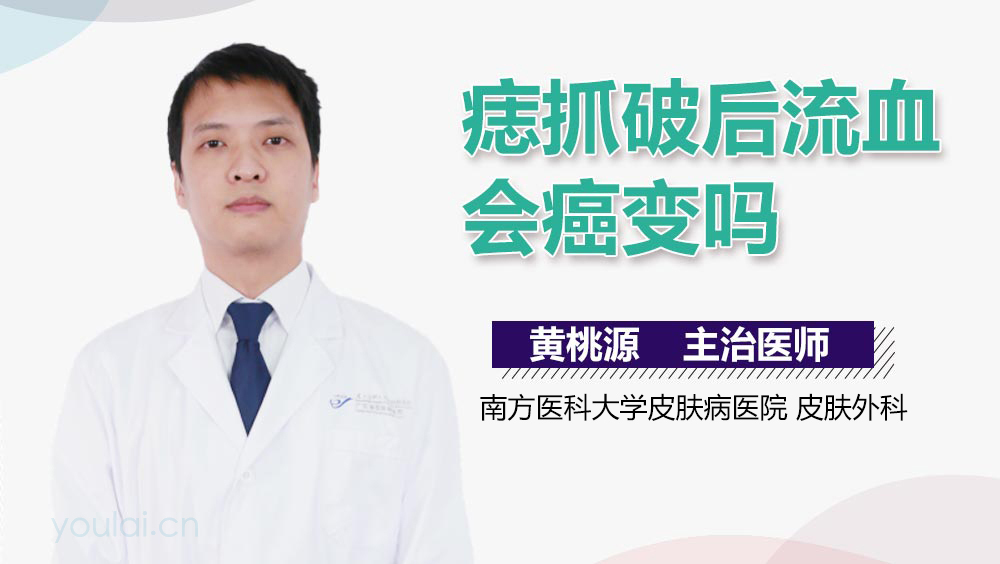 痣抓破后流血会癌变吗