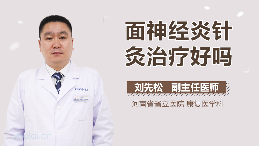 面神经炎针灸治疗好吗