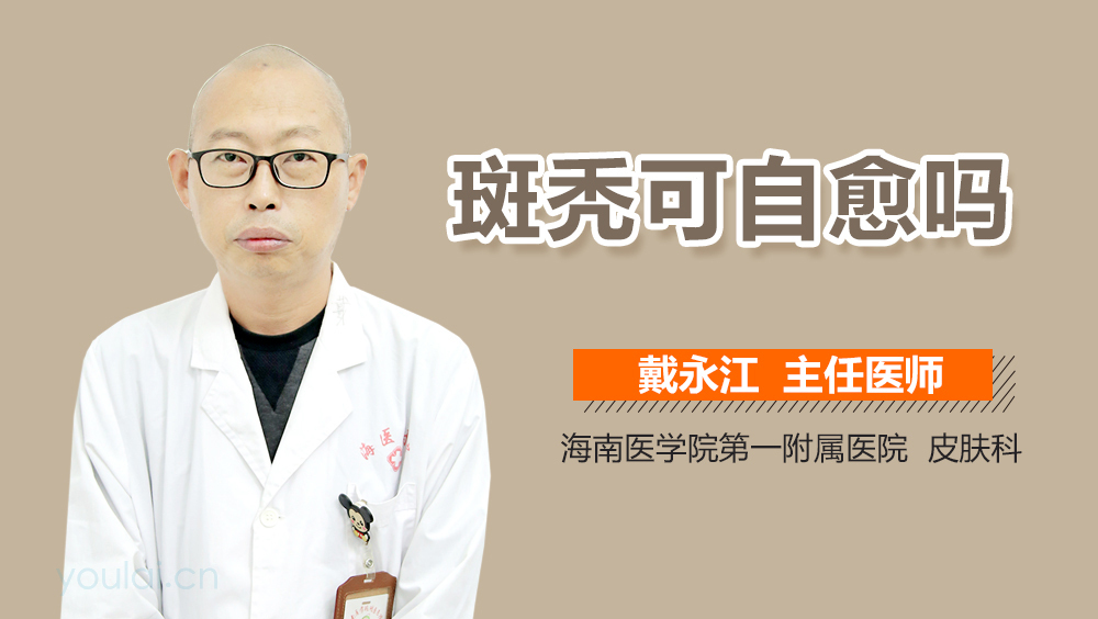 斑秃可自愈吗