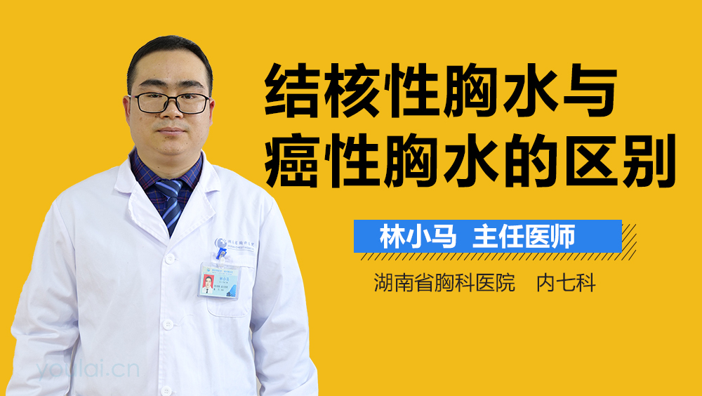 结核性胸水与癌性胸水的区别