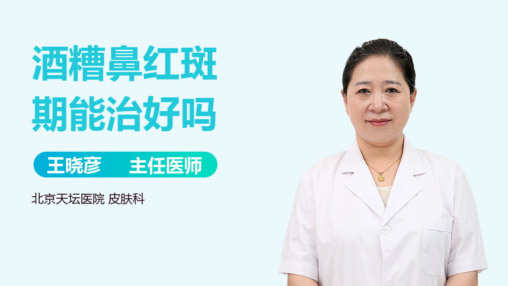 酒糟鼻红斑期能治好吗