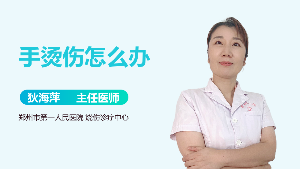 手烫伤怎么办
