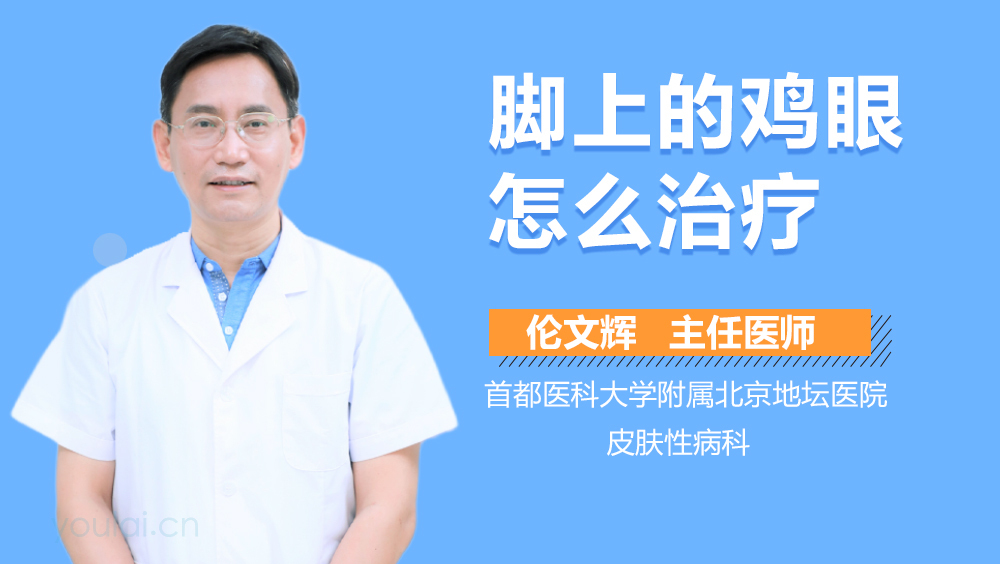 脚上的鸡眼怎么治疗