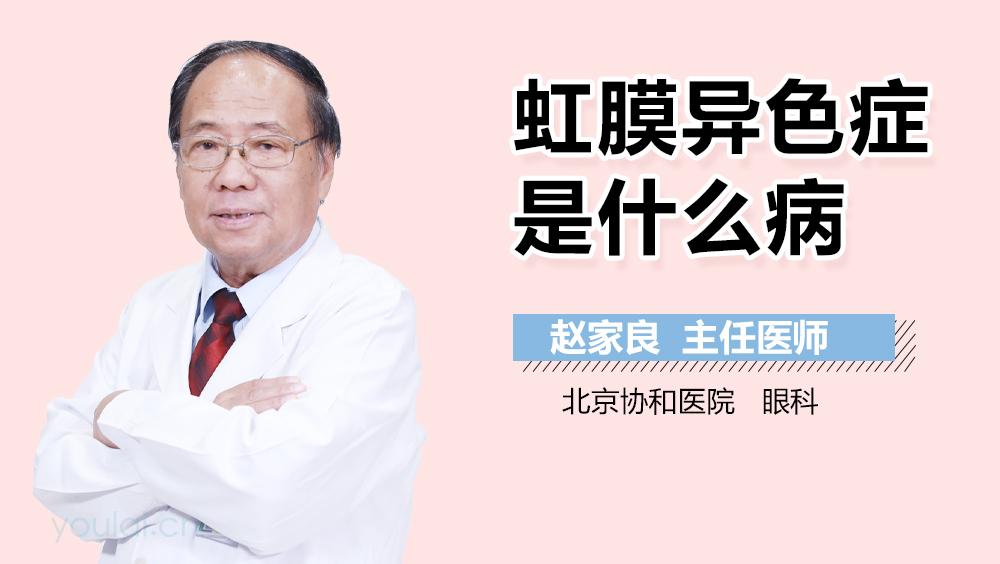 虹膜异色症是什么病