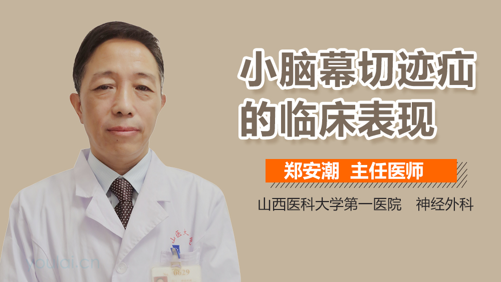 小脑幕切迹疝的临床表现